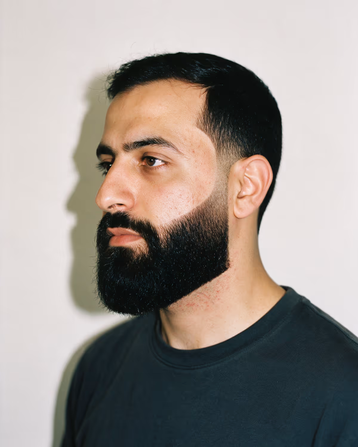 Beard & Line-Up