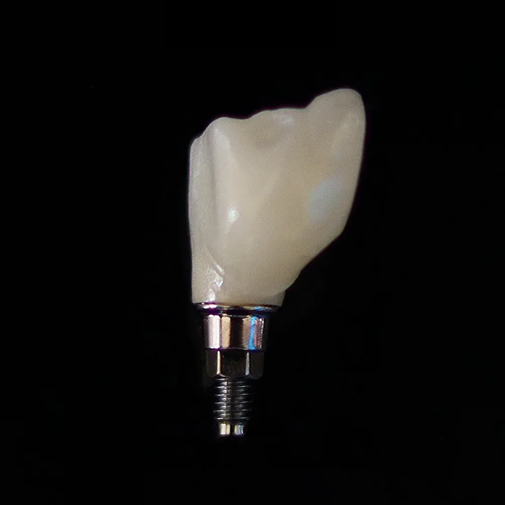 CAD/CAM Restorations